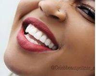 Discount of 77% on Advanced Laser Teeth Whitening